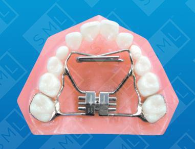 Dillingham Habit-Expansion Appliance U image 1
