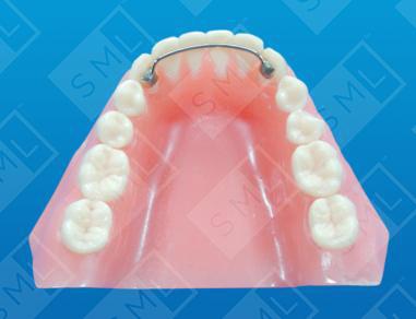 Direct Bond Fixed Retainer
image 1